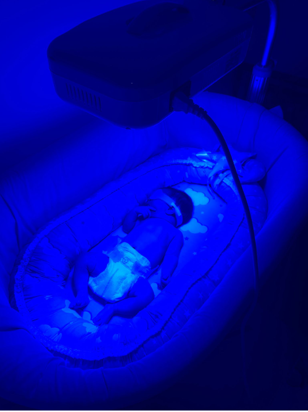 Evde Fototerapi Cihazı