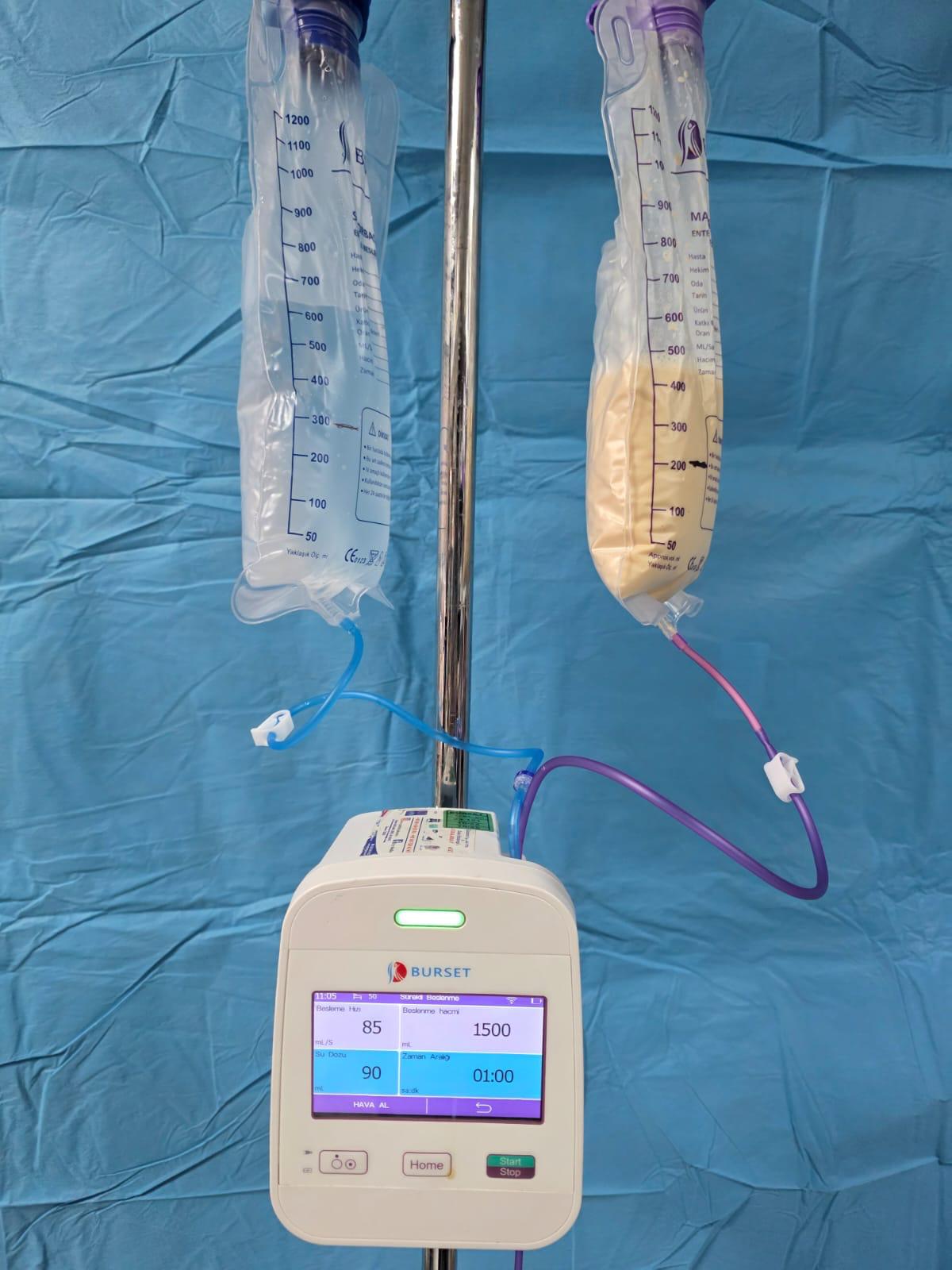 Çiftli Enteral beslenme yıkamalı cihazı (m16) model