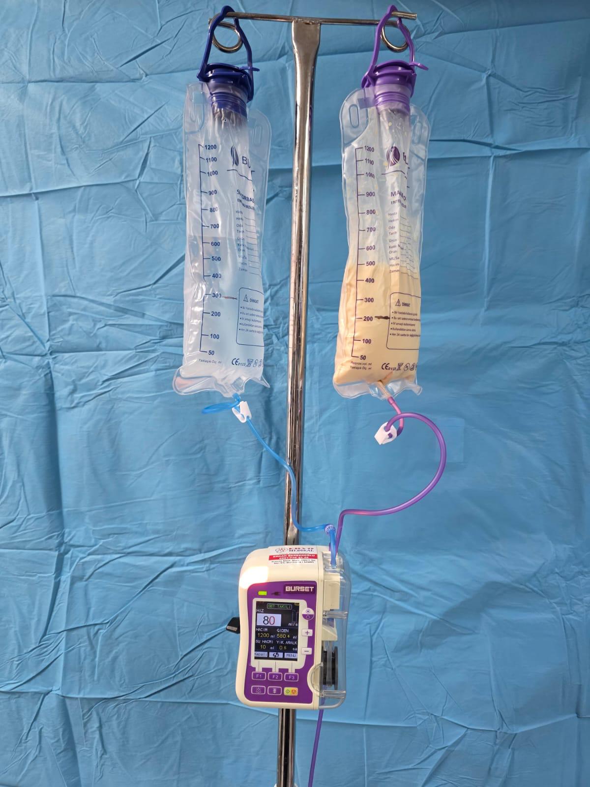 Çiftli enteral beslenme cihazı yıkamalı(beacom) model